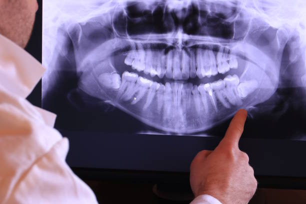 Best Emergency Denture Repair in Pine Bluffs, WY