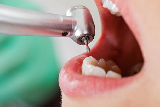 Best Pediatric Emergency Dentist in Pine Bluffs, WY